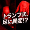 Thumbnail of new posts 113